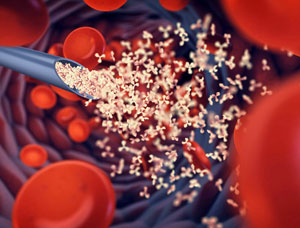 Photo of a needle administering a vaccine