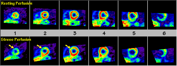 Short Axis-annotated
