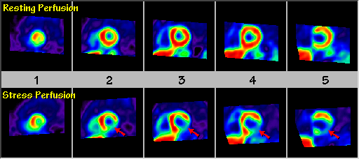 Short Axis-annotated