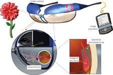 Retinal Prosthesis Schematic