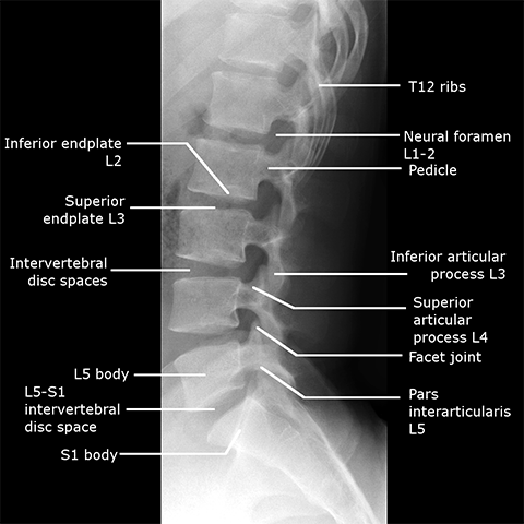 Index of /dept/radiology/radiologysite/images/Med students 19, spine