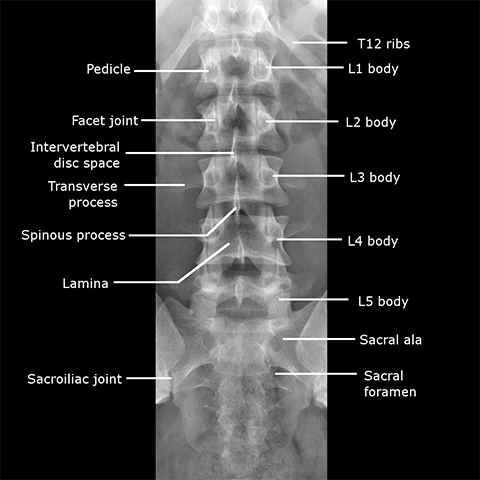 Index of /dept/radiology/radiologysite/images/Med students 19, spine