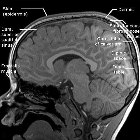 Index of /dept/radiology/radiologysite/images/Med students 20, scalp ...