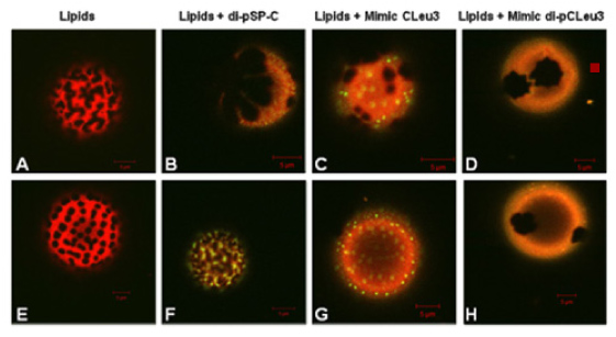 Confocal fluorescence microscopy imaging of GUVs