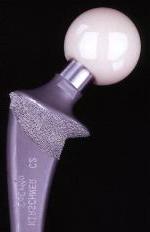 photo of artificial hip