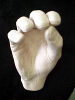 photo of prosthetic hand