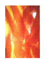 photo of nerve tissue