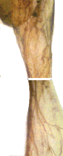 photo of nerve tissue