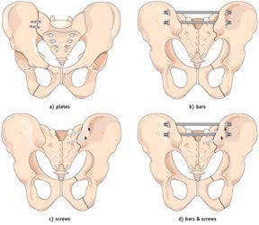 to receive  figure click here