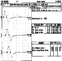 to receive figure click here