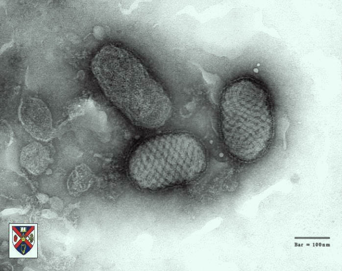 shape of smallpox