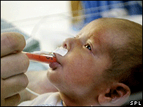 Dehydrated Child receiving ORT