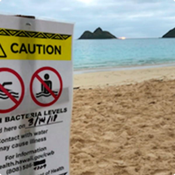 Coastal water quality