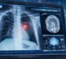Radiology AI