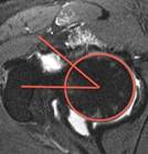 Atlas MSK Measurements