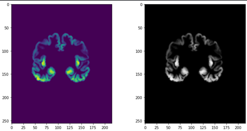 fmri