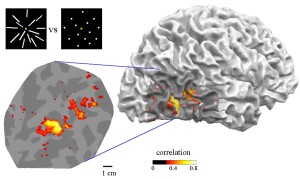 MT activation on cortical surface