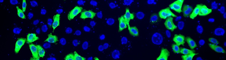 phiC31
              integrase in liver