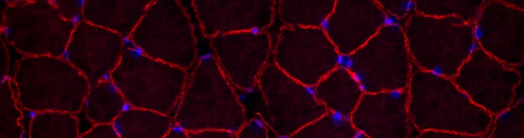 dystrophin in dysferlin-deficient
              A/J skeletal muscle